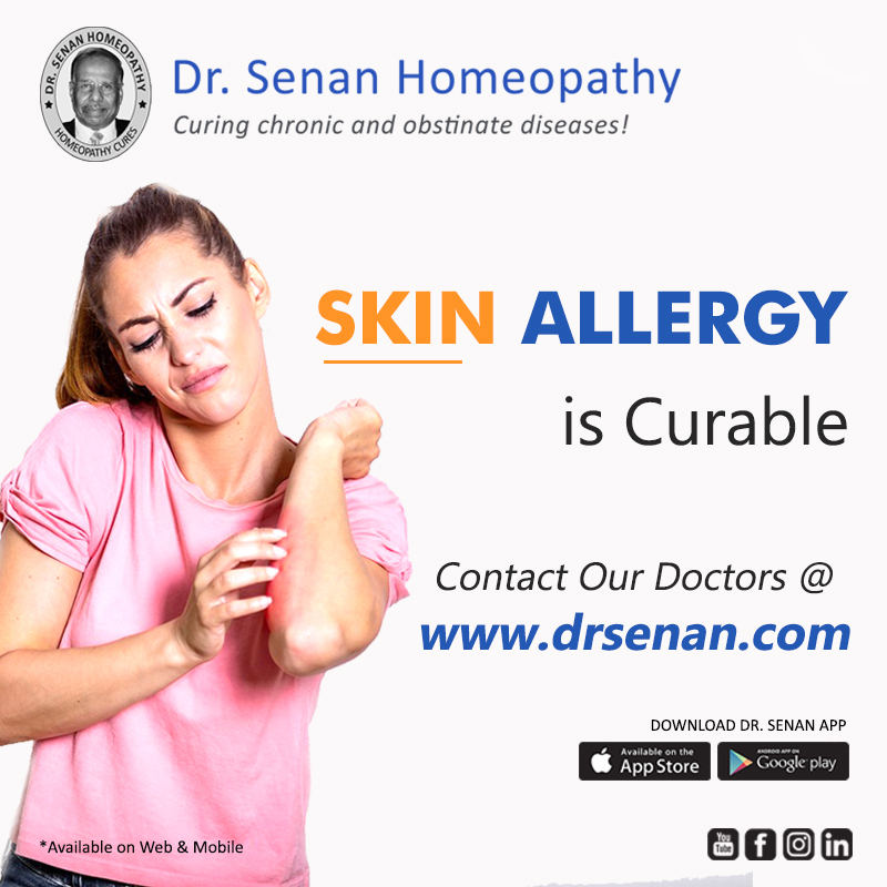 Psoriasis